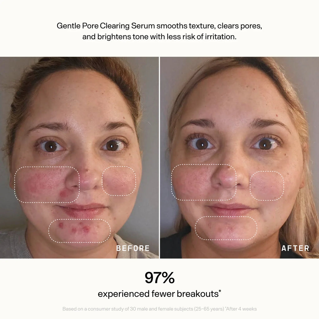 Gentle Pore-Clearing Serum