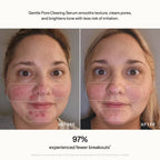 Gentle Pore-Clearing Serum