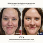 Gentle Pore-Clearing Serum