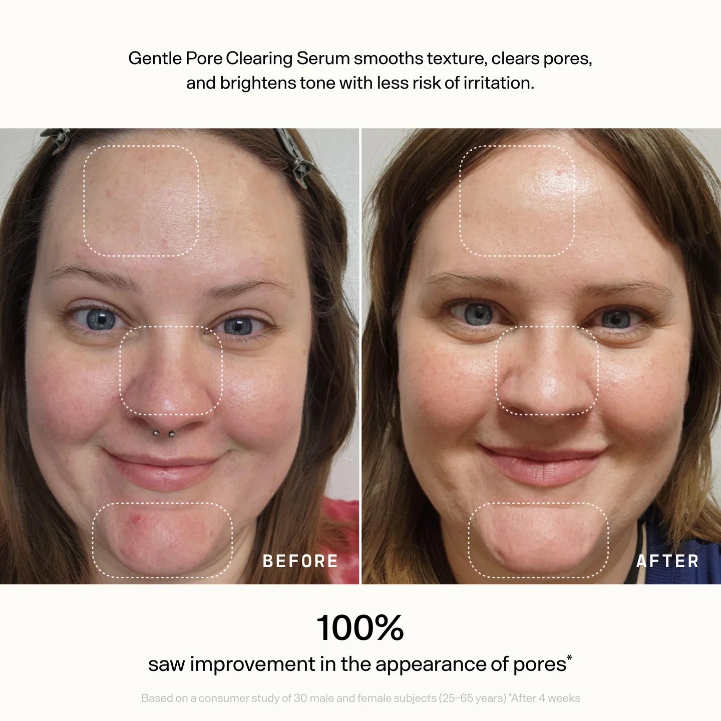 Gentle Pore-Clearing Serum