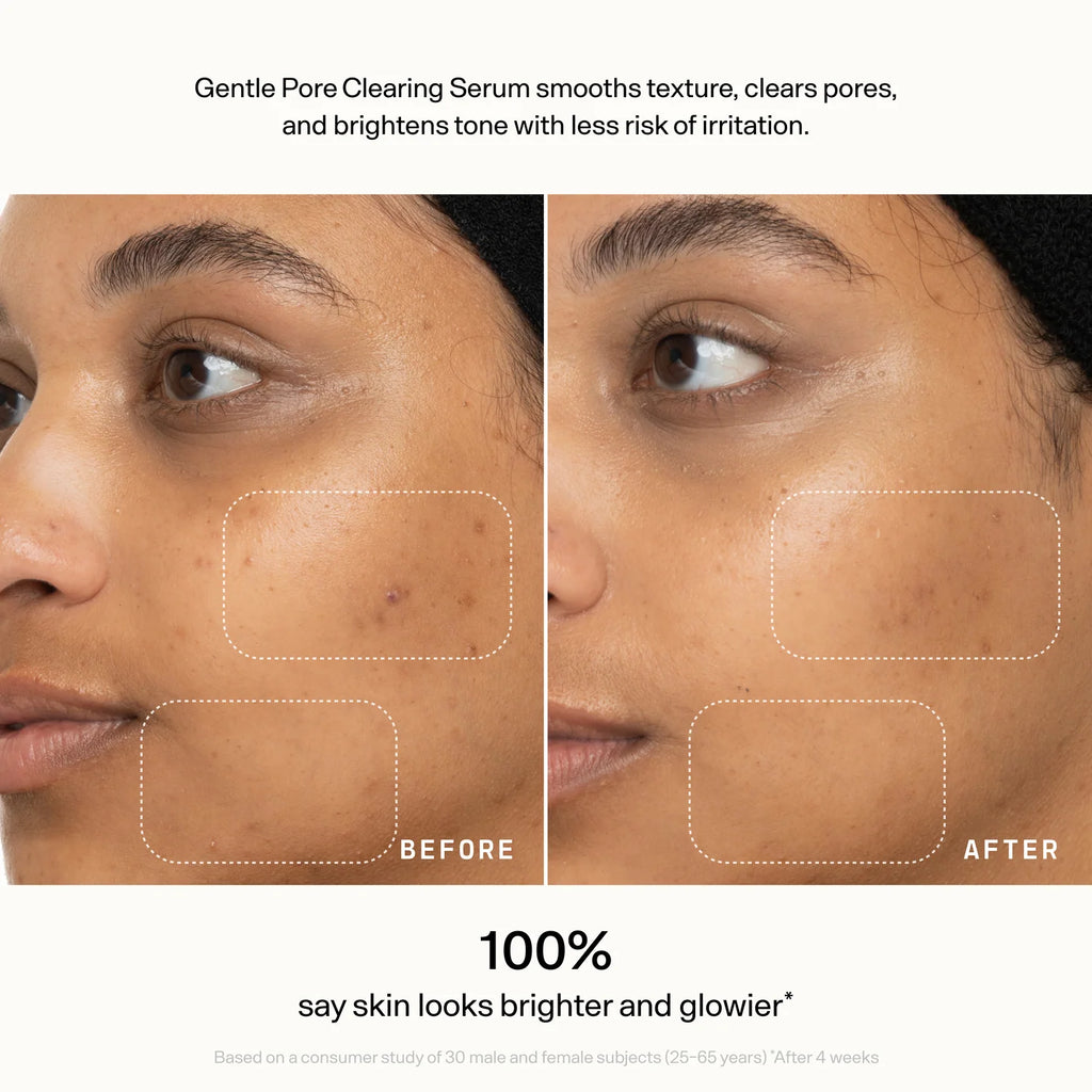 Gentle Pore-Clearing Serum