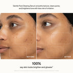 Gentle Pore-Clearing Serum