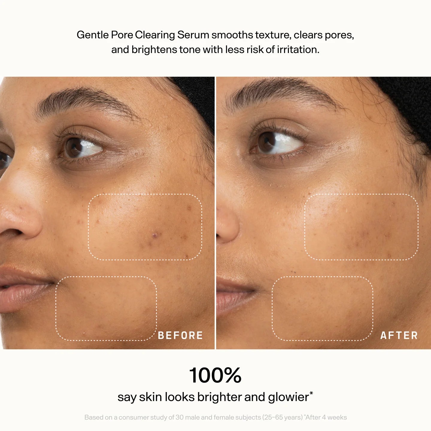 Gentle Pore-Clearing Serum